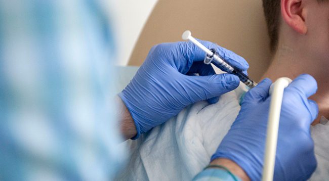 aplicação de toxina botulínica