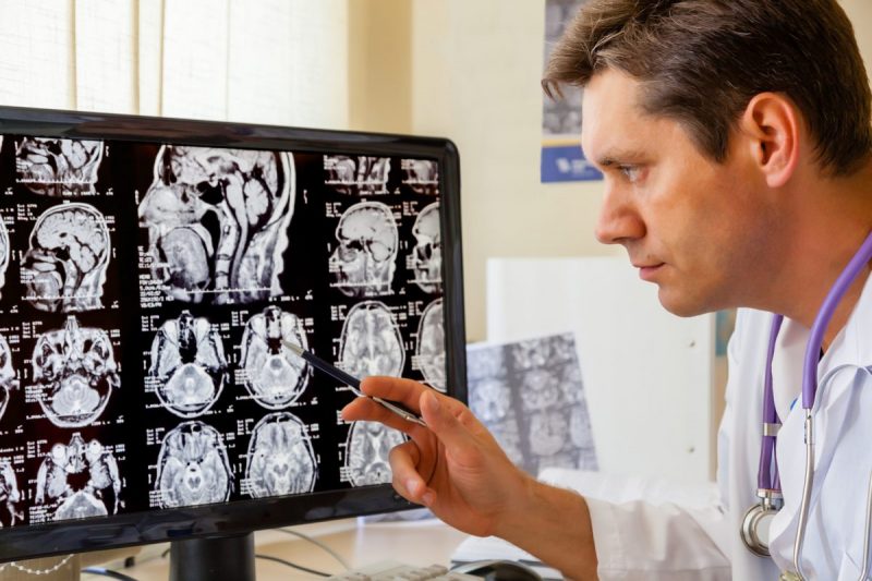 O que faz o Neurologista: Quando procurar este Especialista?